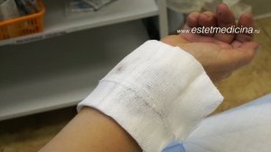 КАК ЛЕЧИТЬ ОЖОГ?: первая помощь + как обрабатывать ожоговую рану ?ПОДПИШИСЬ НА КАНАЛ, ПОДДЕРЖИ НАС!