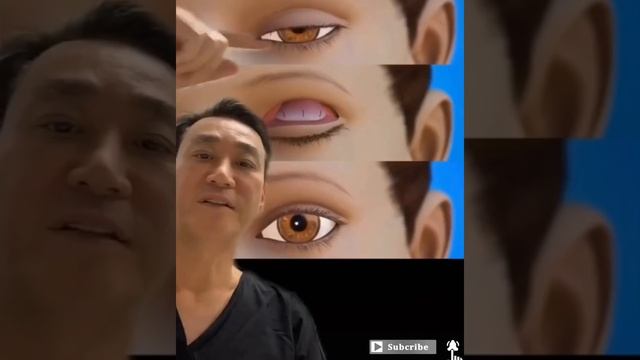 Surgeon EXPOSES kpop idols / celebrities who had plastic surgery ? смотреть онлайн