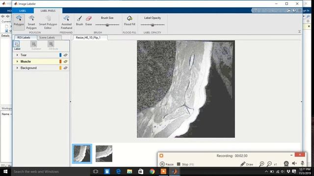 Medical Image Labeling смотреть онлайн