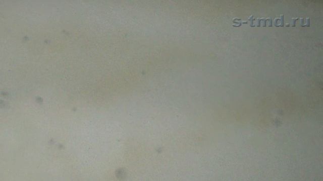 Гипсовая штукатурка что делать чтобы не появился грибок. Профилактика от плесени смотреть онлайн