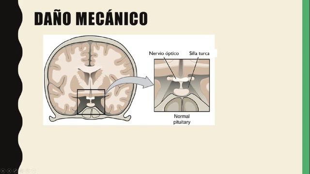 Tumores de hipófisis. Todo lo que necesitas saber смотреть онлайн