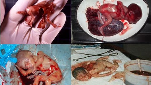 Всё о движении прочойс