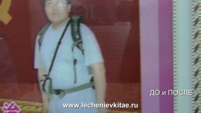 Пластическая хирургия в Китае. Примеры До и После. смотреть онлайн