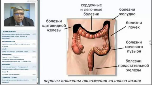 Очистка желудка смотреть онлайн