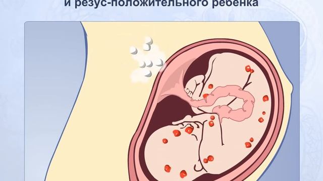 Резус конфликт. Анатомия человека смотреть онлайн