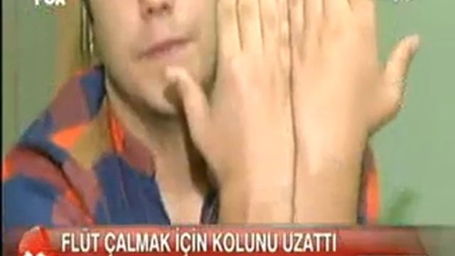 Gaziosmanpaşa Hastanesi- 20,10,2012- FOX HABER FLÜT ÇALMAK İÇİN KOLUNU UZATTI.wmv смотреть онлайн