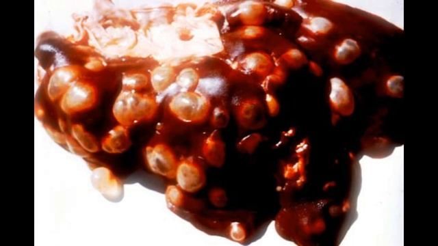 Инфицирование происходит при поглощении личинок ... \ Суворовское училище