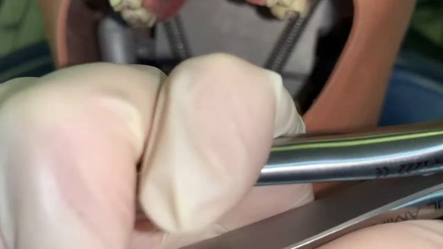 Щипцы для удаления смотреть онлайн