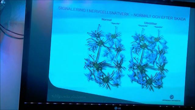 Mindfulness - behandling av hjärntrötthet efter hjärnskada och stroke смотреть онлайн