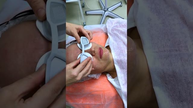 Фотоомоложение - процедура 3 в 1. смотреть онлайн