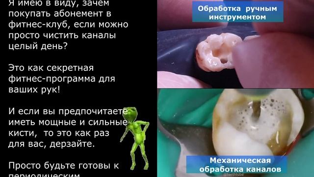 Чем чистить каналы? смотреть онлайн