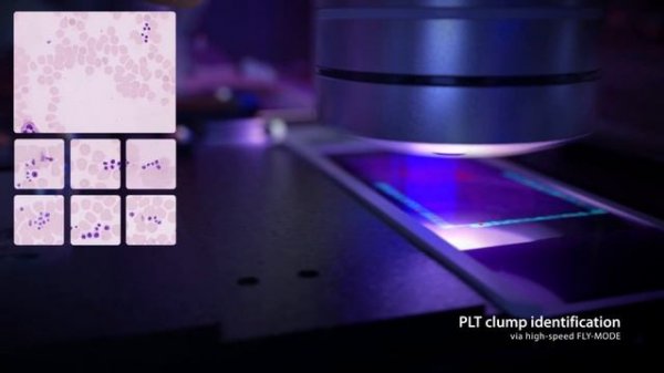 Mindray MC-80 Digital Cell Morphology Analyzer: More Clarity. More Intelligence. More Productivity