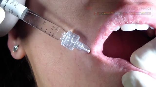 Sculpting Lips 2 смотреть онлайн