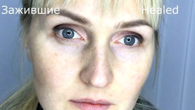Permanent Makeup Eyelids by Roman Klosovskyi смотреть онлайн