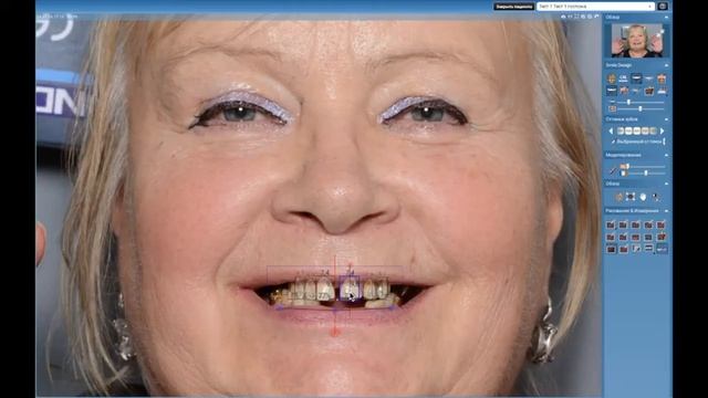 ?⚕️ Вебинар Romexis Smile Design смотреть онлайн