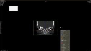 Как посмотреть запись исследования МРТ или КТ на диске
