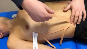 Наложение кинезио тейпа при переломе ребер. Лимфодренажная аппликация при переломе ребер.