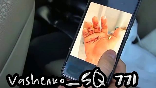 ВОТ ЧТО С РУКОЙ АНТОНА С КАНАЛА МАКС ВАЩЕНКО! ТГ МАКС ВАЩЕНКО! ГО 10 ЛАЙКОВ💜🥱 ГО ЕЩЕ 15 САБОВ🙏💜🔥 смотреть онлайн