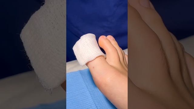 Мазь Браунодин и бинт Пеха -Хафт для перевязки вросшего ногтя смотреть онлайн