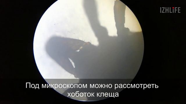 Клещ под микроскопом смотреть онлайн