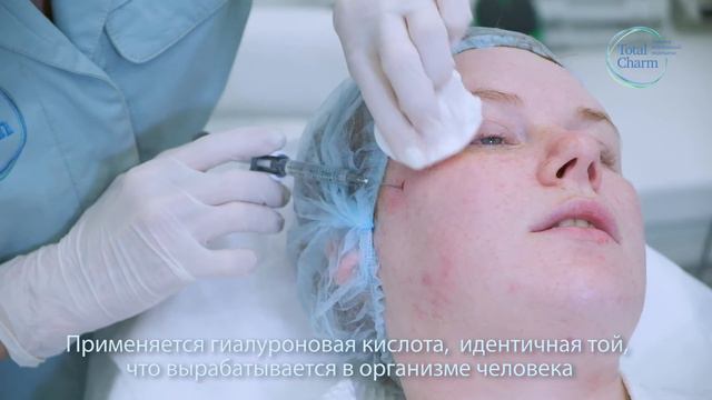 Контурная пластика филлерами Juvederm смотреть онлайн