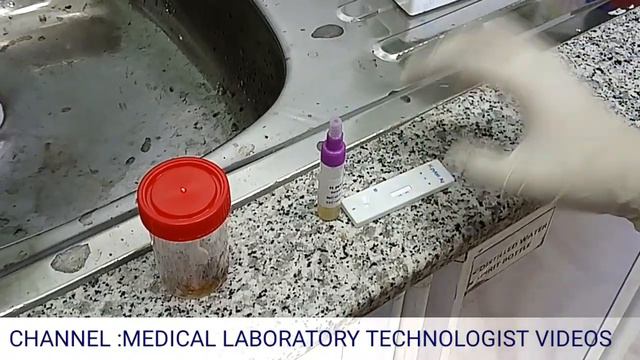 H.Pylori stool antigen rapid test.An easy way to understand in Hindi and Urdu. смотреть онлайн