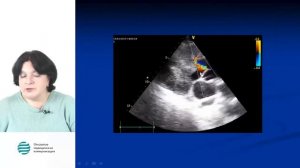 Лёгочная гипертензия, эхокардиография, Рыбакова М К , вебинар 19 10 2017