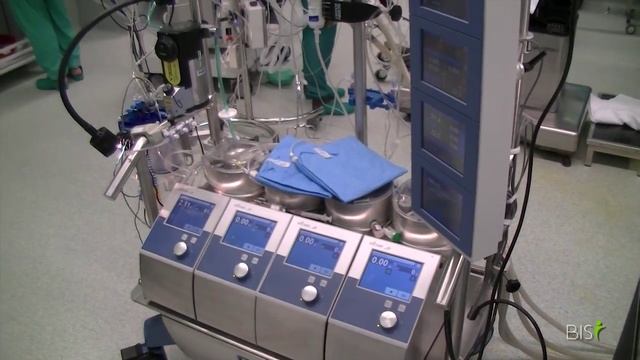 Cardiac Bypass Surgery Dr. Ruyra | BISI смотреть онлайн