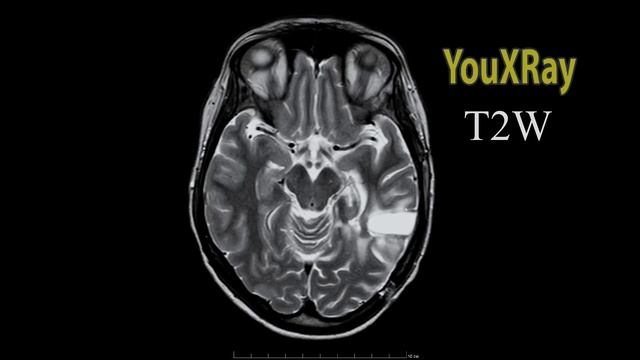 Анатомия и Физиология Человека