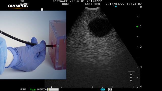 EBUS-TBNA: How to Position the Lesion in the Ultrasound Image | Pulmonology | OLYMPUS смотреть онлайн