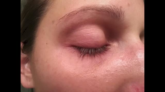 Longer Lashes By Latisse