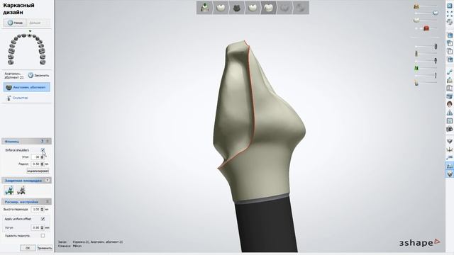 3Shape тренинг смотреть онлайн