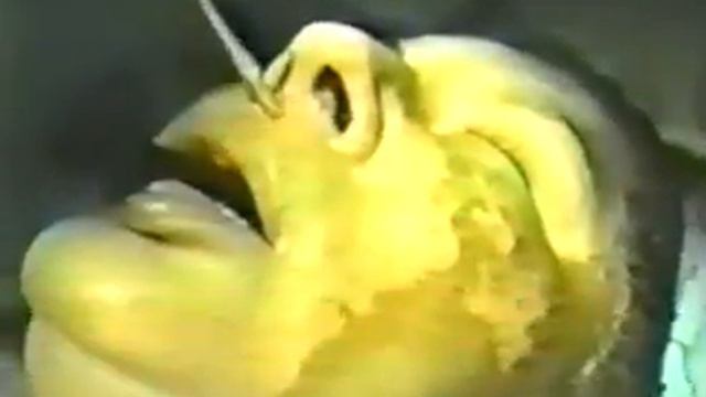 VITILIGO +PEELING PROFUNDO FENOL CROTON смотреть онлайн