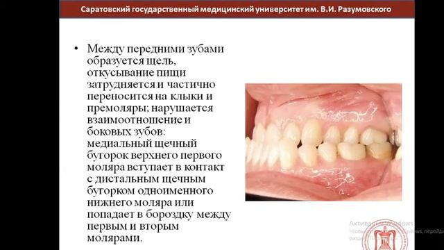 Биомеханика нижней челюсти. Артикуляция. Окклюзия и ее виды. Лекция от 20 11 2020