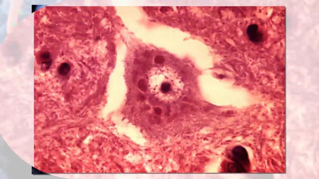 Top 10 Most Dangerous Bacteria on Earth | dangerous bacteria смотреть онлайн