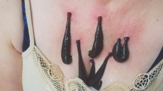 Пиявки смотреть онлайн