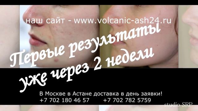 Что помогает от пятен от прыщей смотреть онлайн