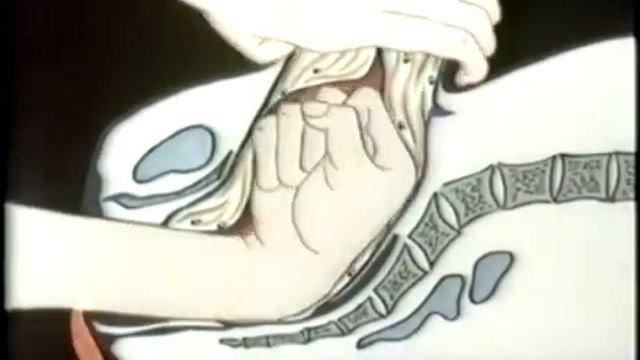 Акушерские кровотечения при гипотонии матки смотреть онлайн