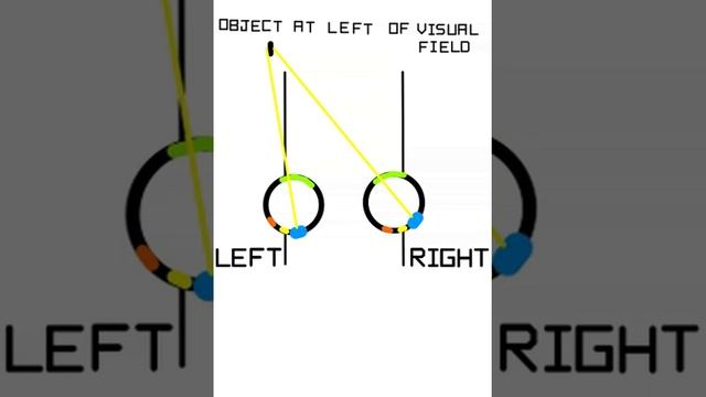 diplopia- uncrossed vs crossed смотреть онлайн
