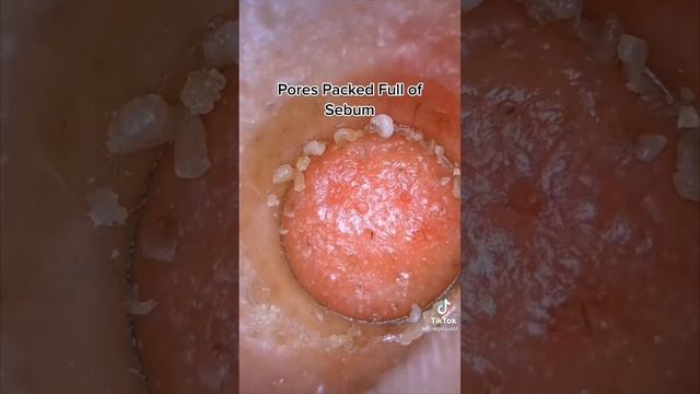 Странная чистка лица смотреть онлайн