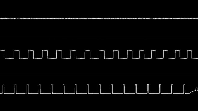 DRAX - "Tristesse" (C64) [Oscilloscope View] смотреть онлайн