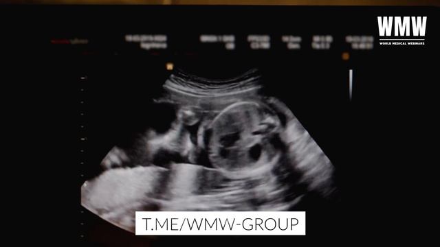 Врождённые пороки развития верхней конечности | WMW смотреть онлайн