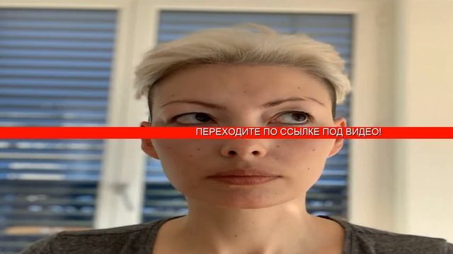 Отеки на глазах верхнее веко как избавиться смотреть онлайн