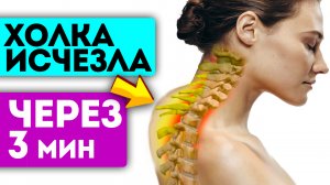 Вдовий горбик исчез! Смотрите, что делают старые ревматологи для удаления холки