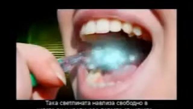 Йонна четка за зъби смотреть онлайн