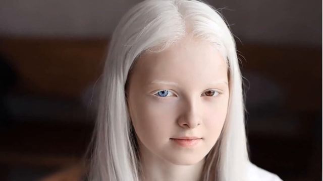 Одна на миллион: чеченская девочка шокировала своей «инопланетной красотой» смотреть онлайн