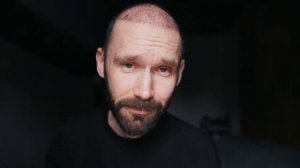 2 месяца с пересадки волос