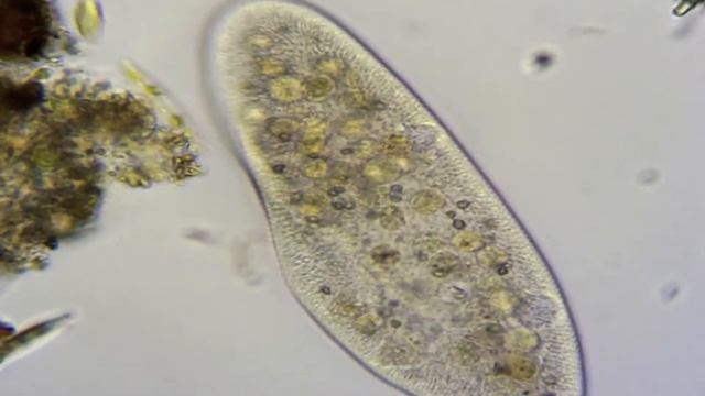 Инфузория туфелька под микроскопом Paramecium caudatum under the microscope смотреть онлайн
