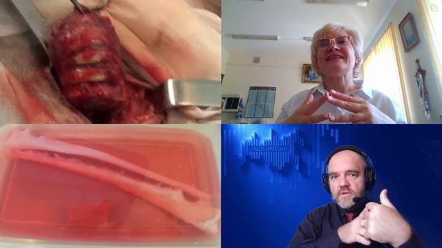 1101. Н.Ю. Анисимова: Новейшие биоимплантаты срастаются с организмом по его командам