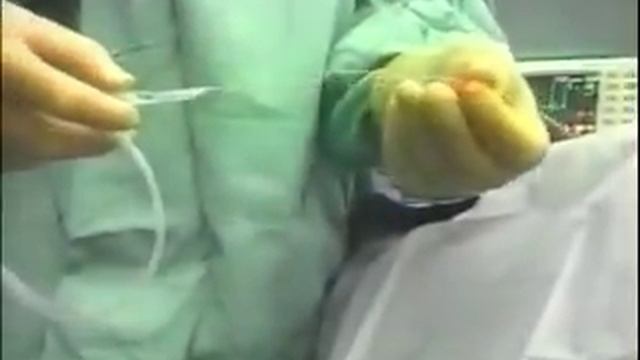Катетеризация ЦВ по Сельдингеру.flv смотреть онлайн